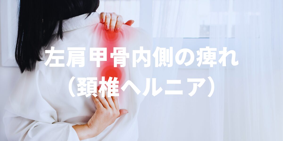 左肩甲骨内側の痺れ(頸椎ヘルニア)