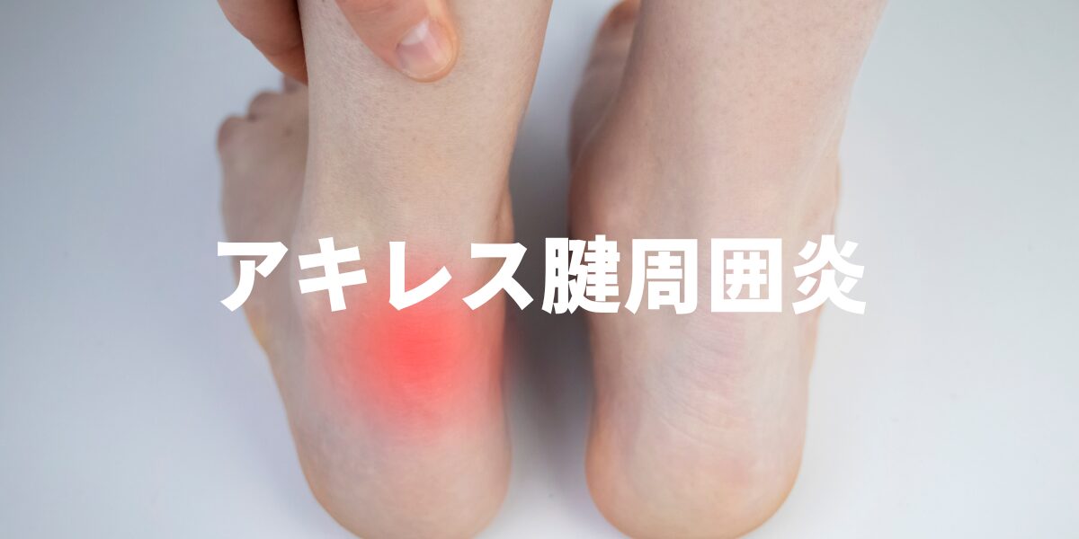 アキレス腱周囲炎