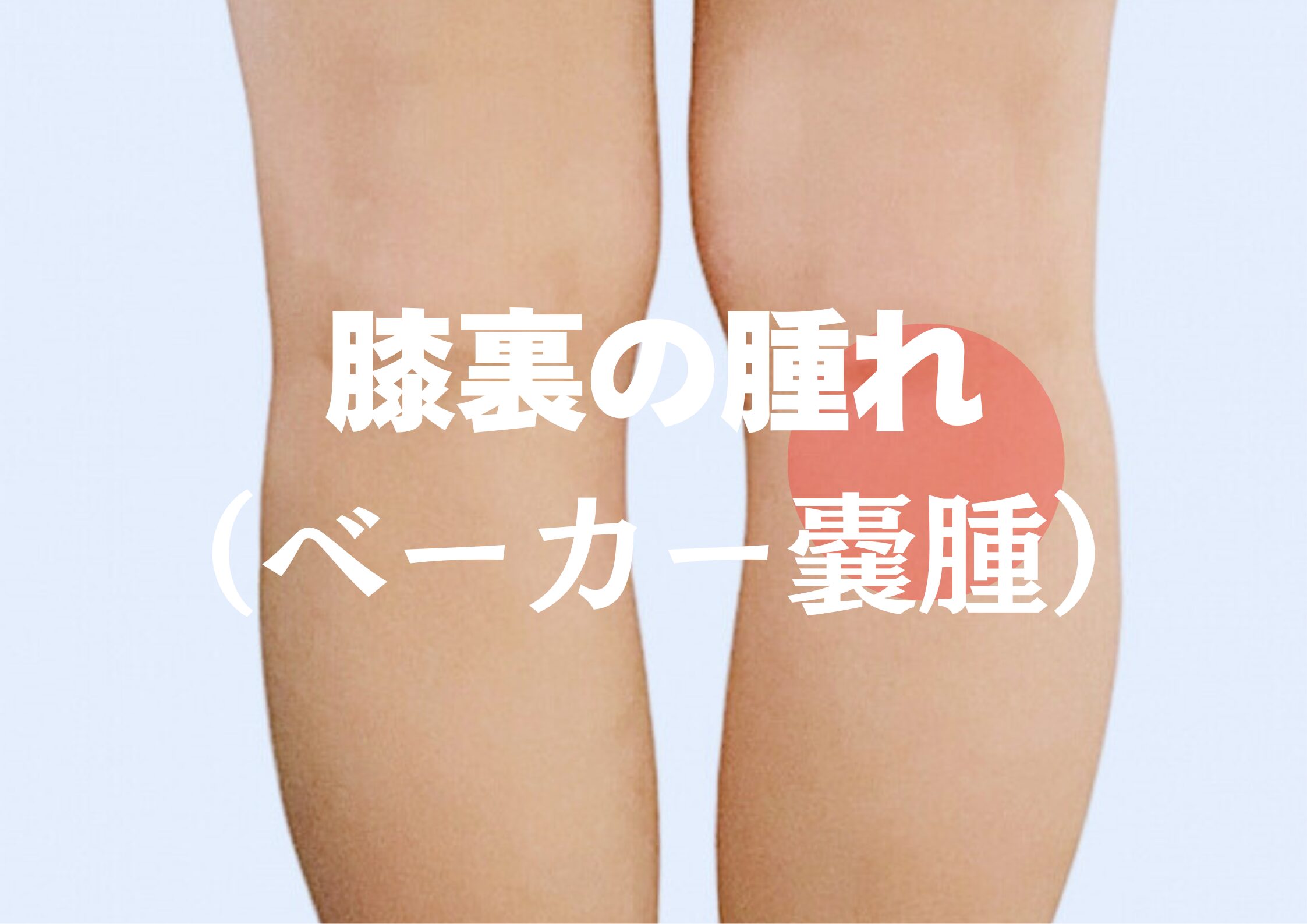 膝裏の痛み・腫れ（ベーカー嚢腫）