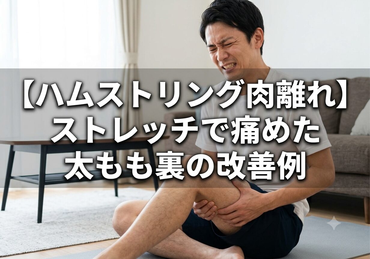 【ハムストリング肉離れ】ストレッチで痛めた 太もも裏の改善例