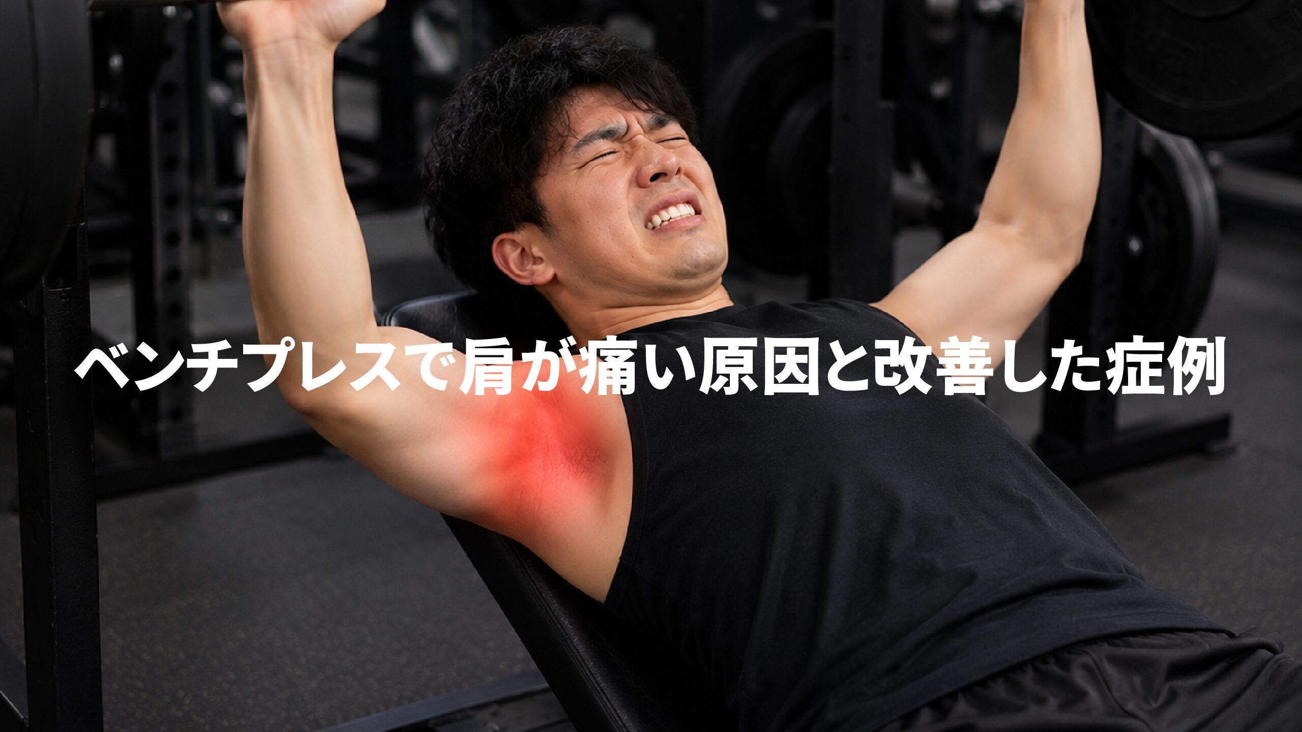 ベンチプレスで肩が痛い原因と改善した症例
