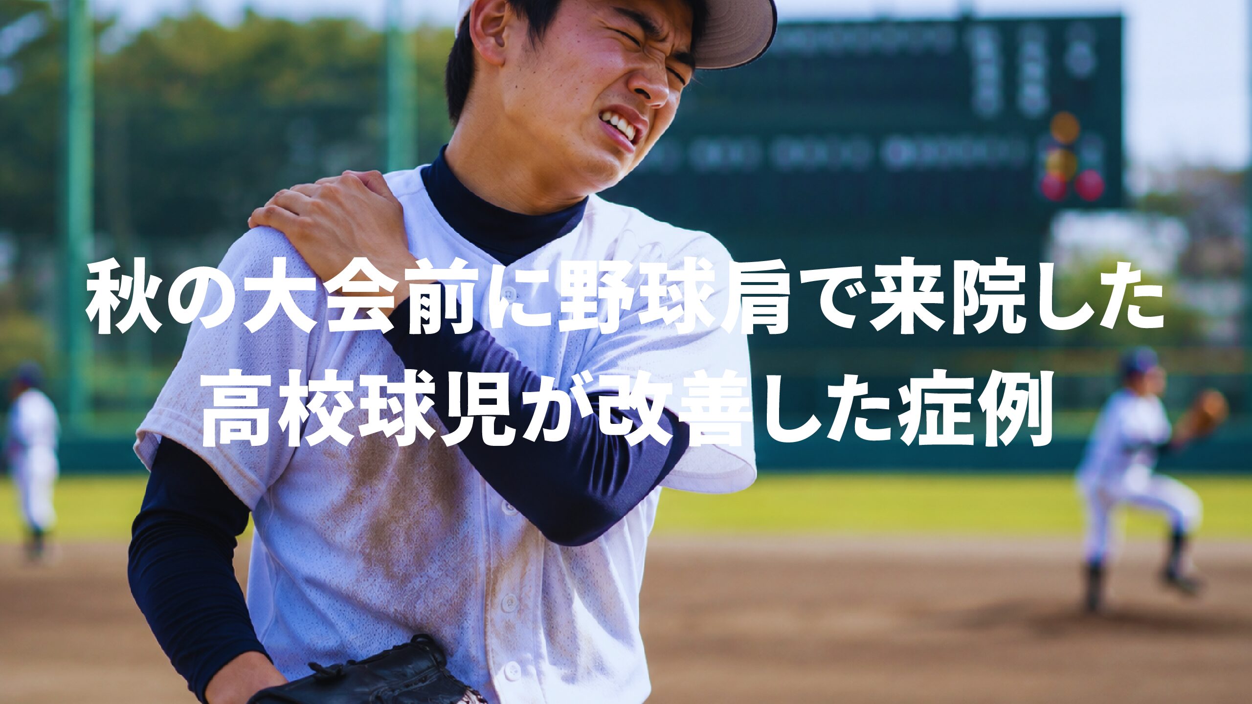 秋の大会前に野球肩で来院した高校球児が改善した症例