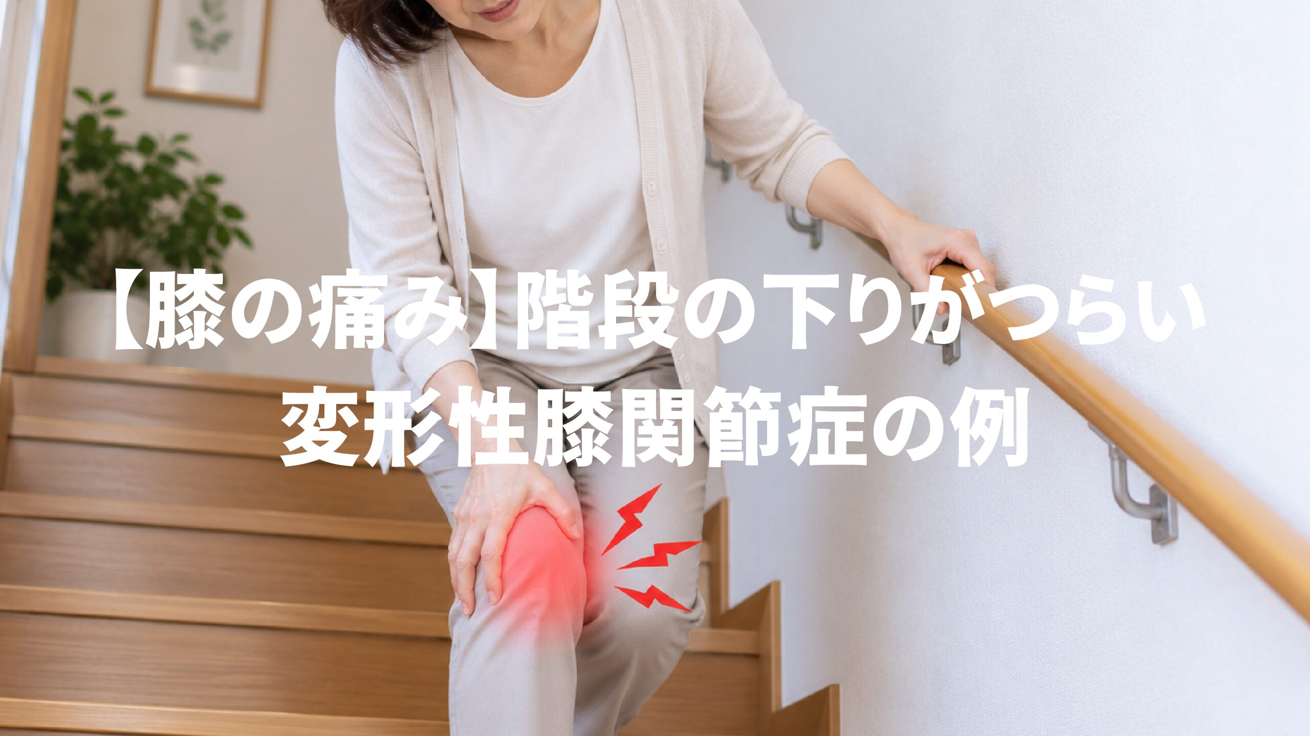 【膝の痛み】階段の下りがつらい変形性膝関節症の例