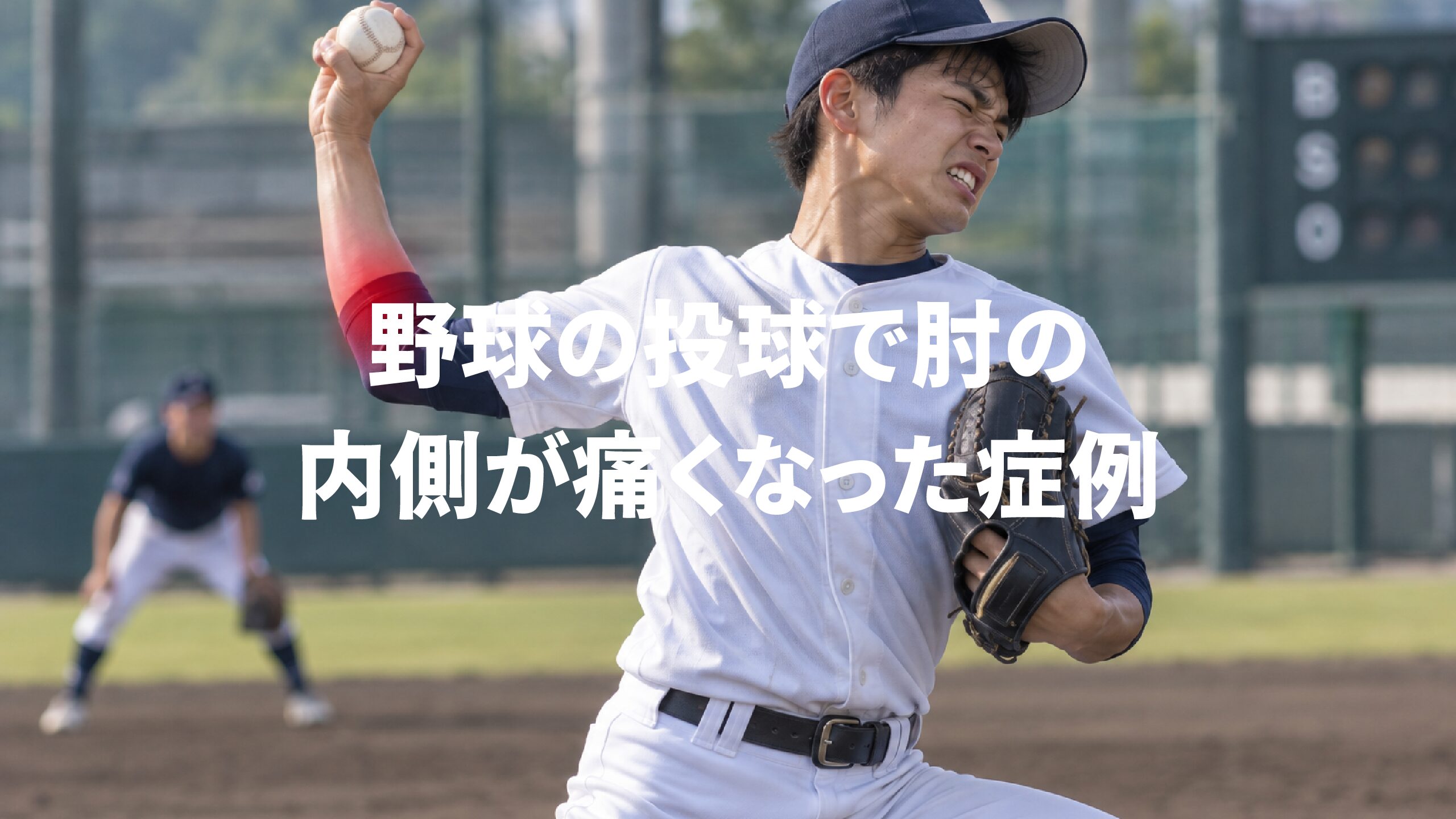 野球の投球で肘の内側が痛くなった症例
