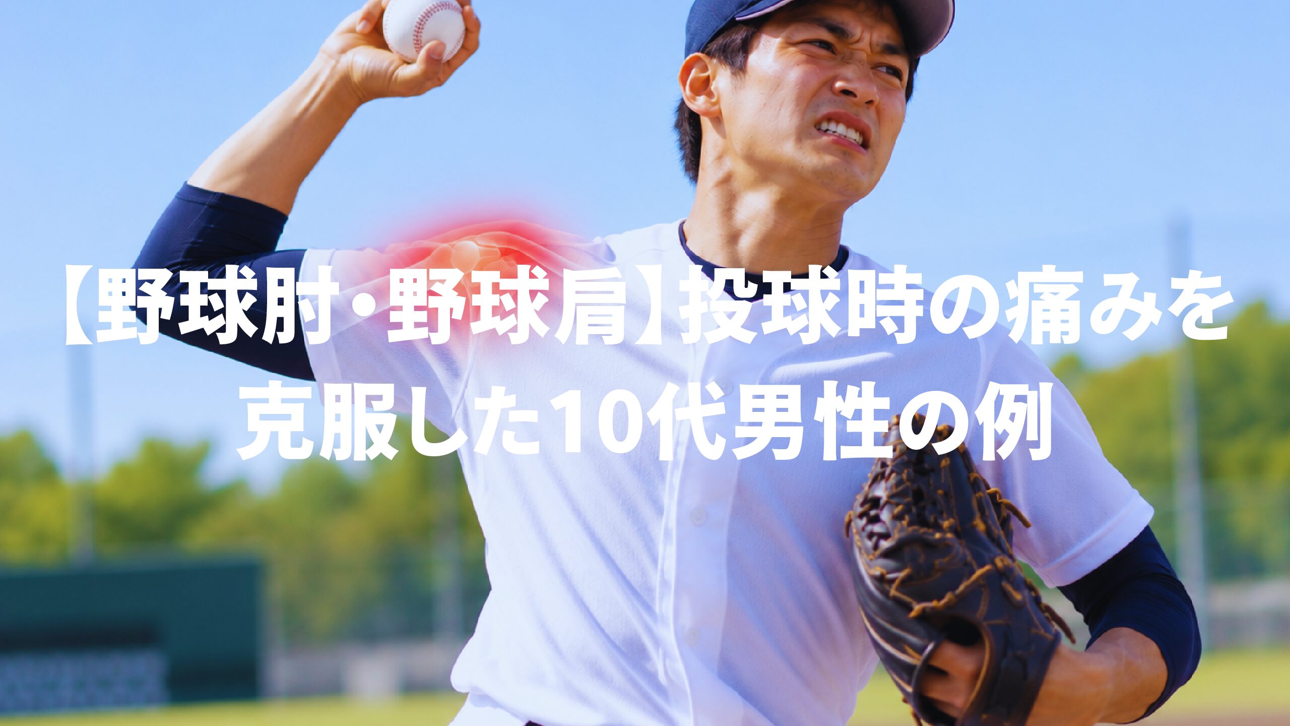 【野球肘・野球肩】投球時の痛みを克服した10代男性の例