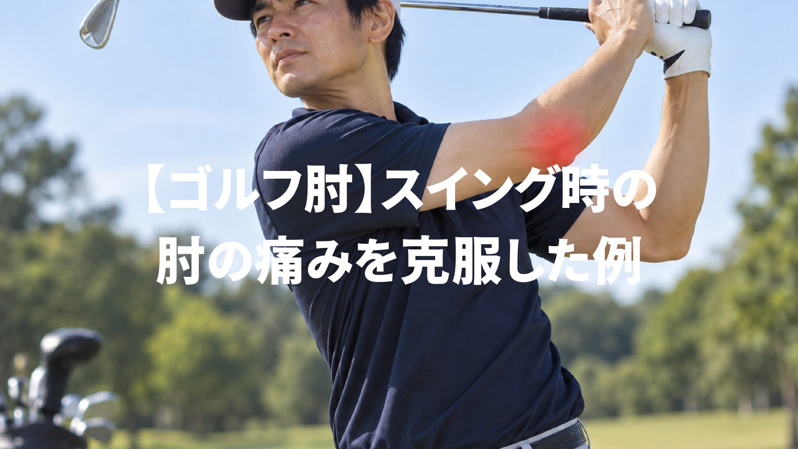 【ゴルフ肘】スイング時の肘の痛みを克服した例
