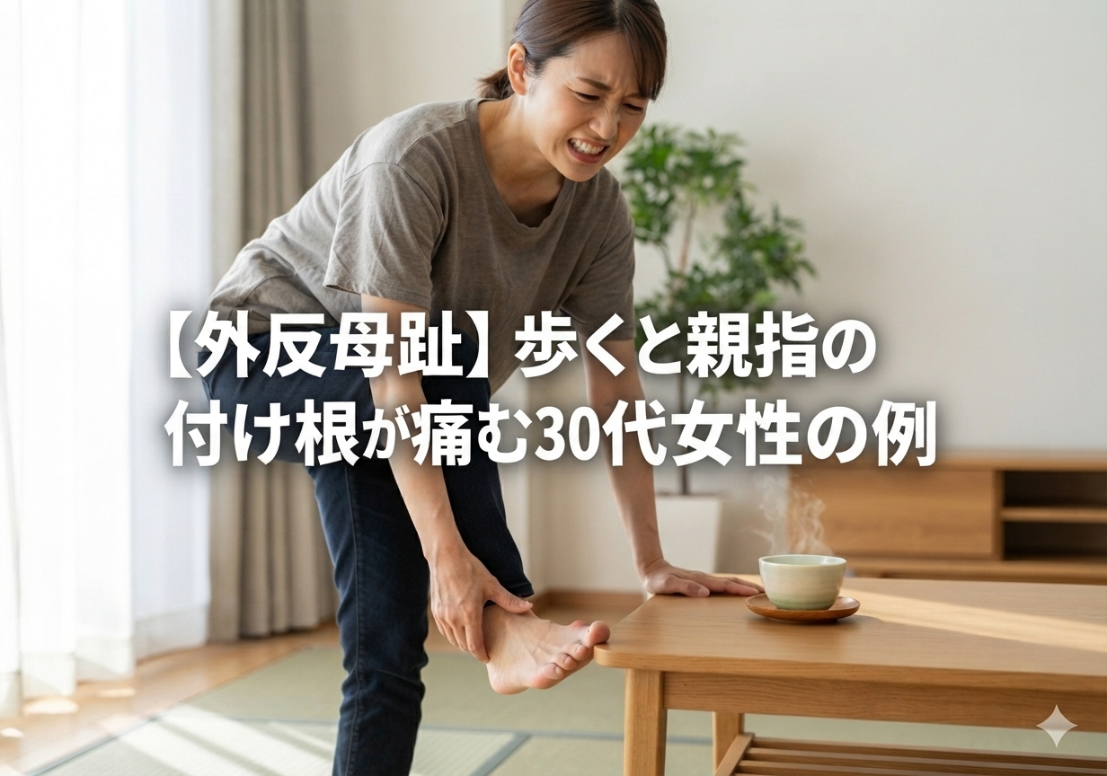 【外反母趾】歩くと親指の付け根が痛む30代女性の例