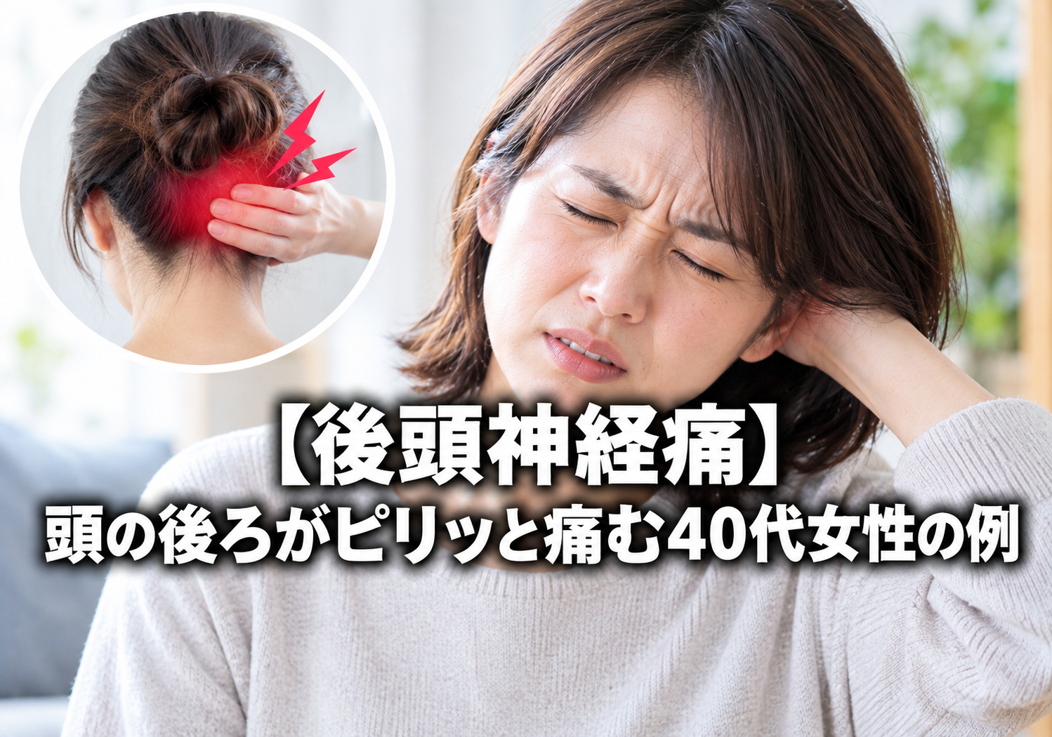 【後頭神経痛】頭の後ろがピリッと痛む40代女性の例